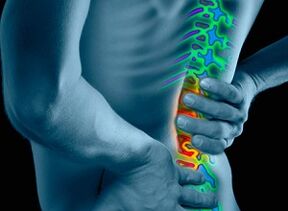 osteokondrozning sabablari va alomatlari