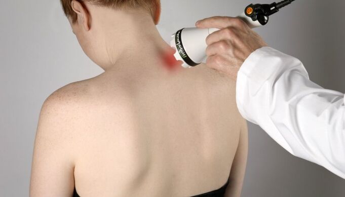 Servikal osteokondroz uchun lazer terapiyasi